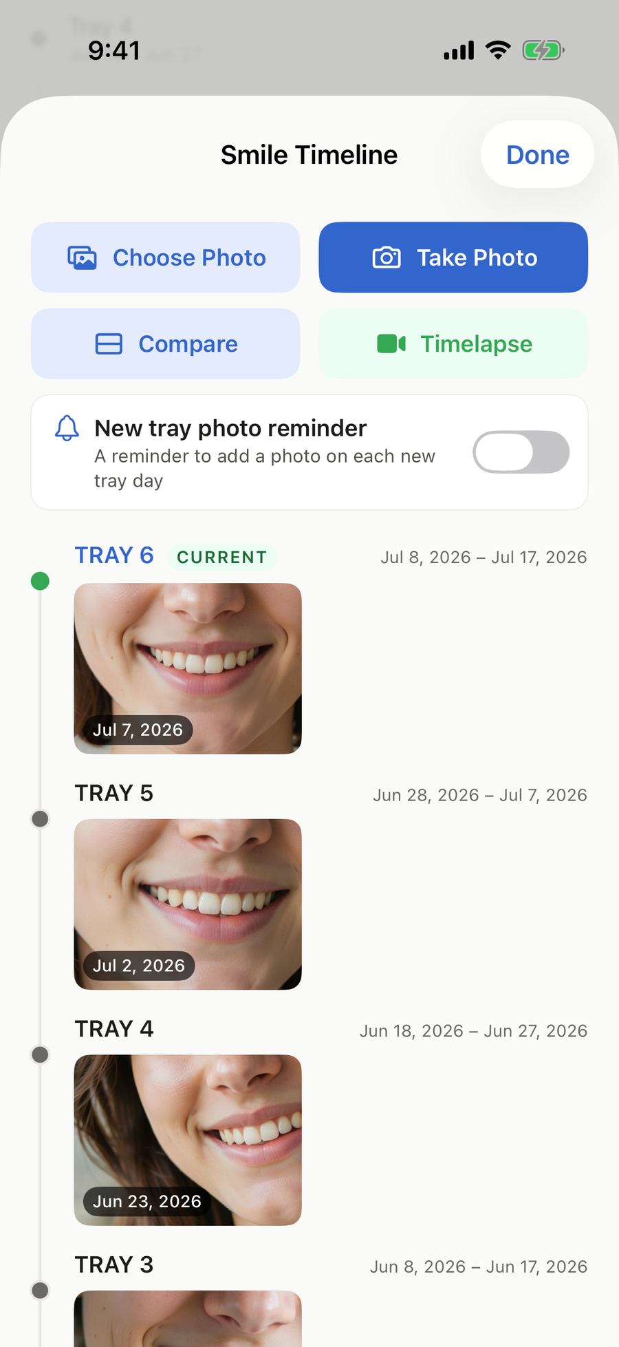OutTime Smile Timeline showing dated smile photos across trays, with buttons to choose or take a photo, compare, and make a timelapse video